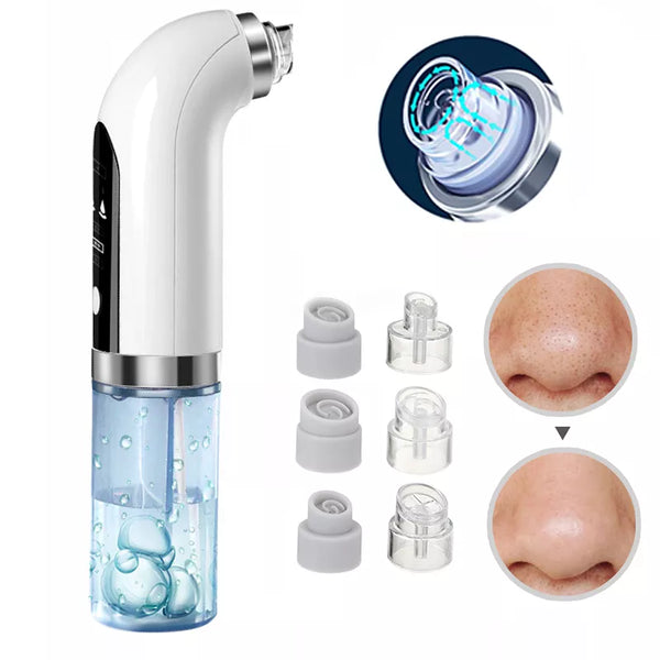 Pore Cleanse Pro Blackhead Vacuum